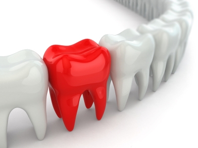 Genuine Family Dentistry | Periodontal Therapy, Exam And Cleaning and Root Canal Therapy