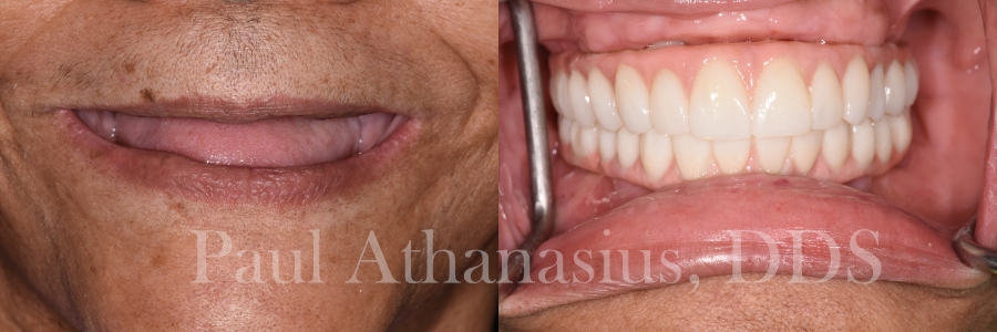 Genuine Family Dentistry | Cosmetic Dentistry, Crowns and Emergency Treatment