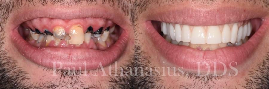 Genuine Family Dentistry | Full Mouth Reconstruction, Emergency Treatment and Ceramic Crowns