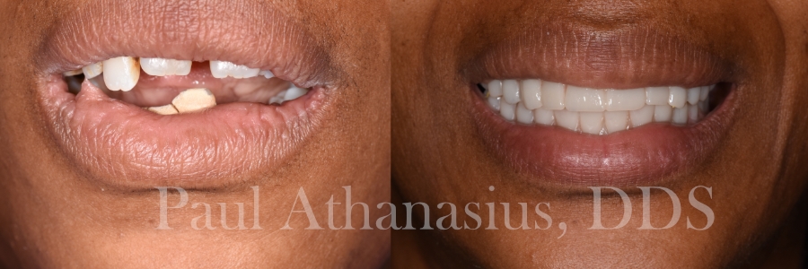 Genuine Family Dentistry | Veneers, Preventative Program and All-on-4 reg 