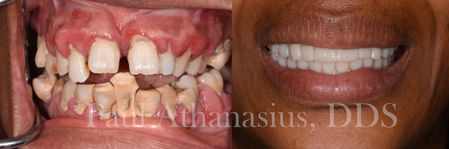 Genuine Family Dentistry | Oral Exams, LANAP reg  and Preventative Program