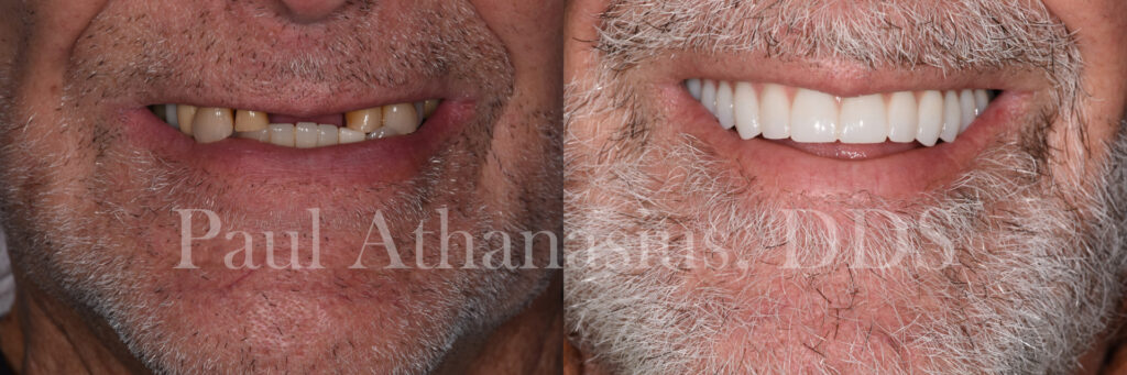 Genuine Family Dentistry | Implant Restorations, Emergency Treatment and Oral Cancer Screening