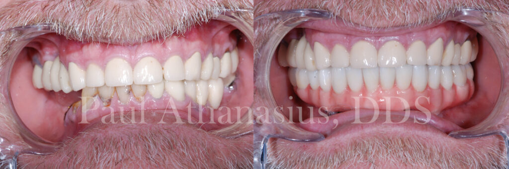 Genuine Family Dentistry | Intraoral Camera, Juvederm® and Inlays & Onlays