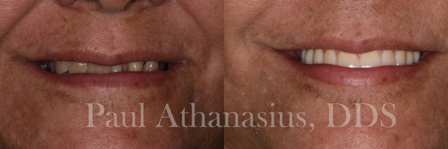 Genuine Family Dentistry | E4D, All-on-6 reg  and LANAP reg 