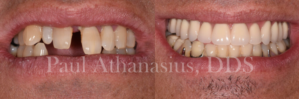 Genuine Family Dentistry | Dentures, Orthodontics and Snoring Appliances