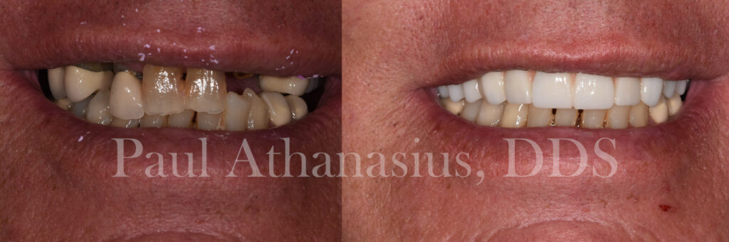 Genuine Family Dentistry | Pediatric Dentistry, Implant Dentistry and Ceramic Crowns