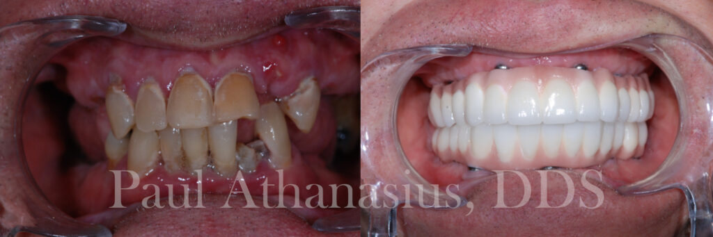 Genuine Family Dentistry | Dental Sealants, Intraoral Camera and Dental Cleanings