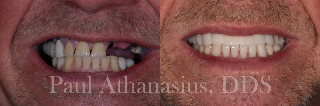 Genuine Family Dentistry | Intraoral Camera, LANAP® and Dental Cleanings