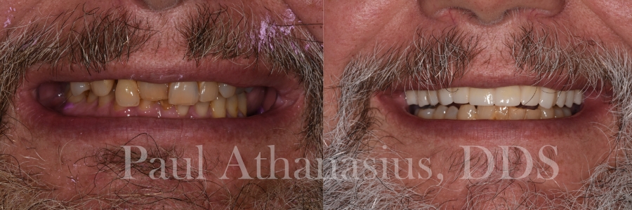 Genuine Family Dentistry | Botox reg , All-on-6 reg  and Sedation Dentistry