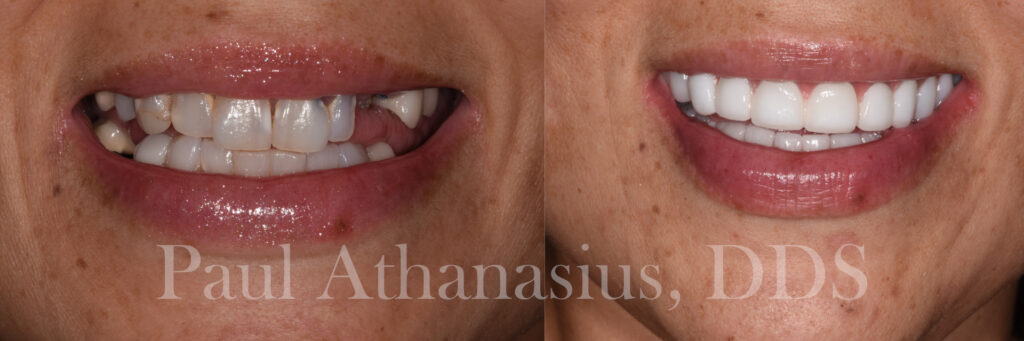 Genuine Family Dentistry | Oral Cancer Screening, VELscope® Cancer Screening and Dentures