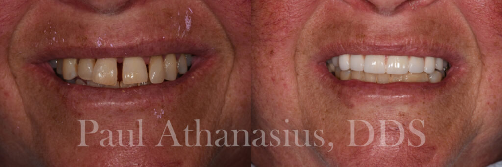 Genuine Family Dentistry | Emergency Treatment, ZOOM! Whitening and Veneers