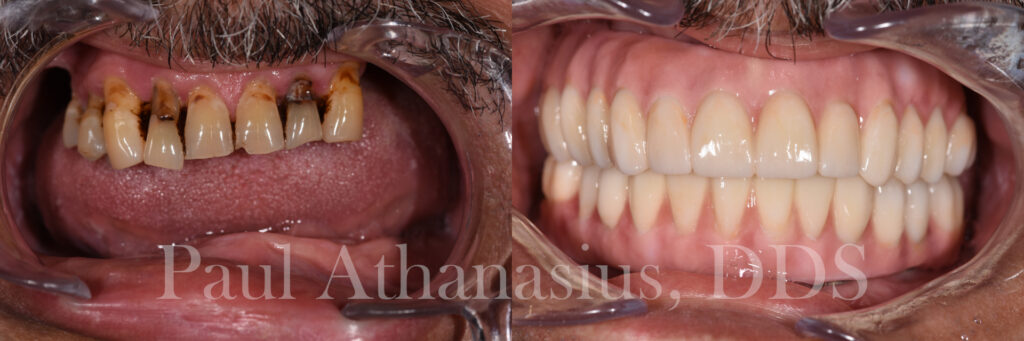 Genuine Family Dentistry | Inlays & Onlays, ZOOM! Whitening and Pediatric Dentistry