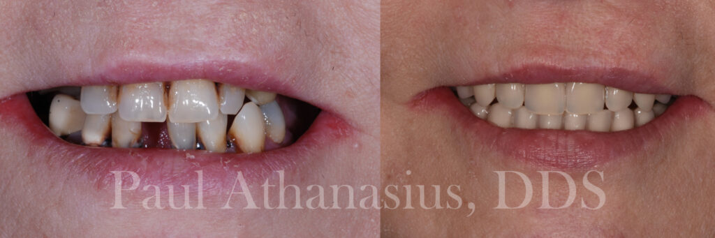 Genuine Family Dentistry | VELscope® Cancer Screening, Sedation Dentistry and Juvederm®