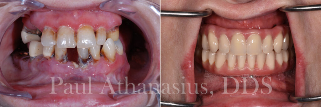 Genuine Family Dentistry | LANAP®, Sedation Dentistry and Veneers