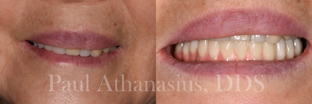 Genuine Family Dentistry | Sedation Dentistry, Implant Dentistry and Dental Cleanings