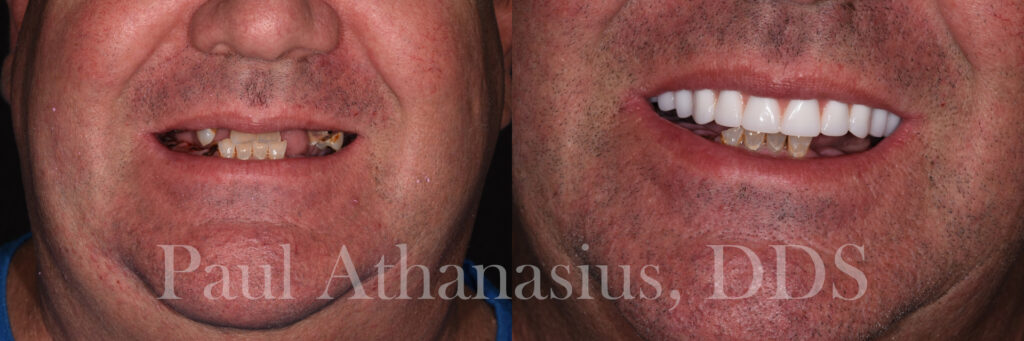 Genuine Family Dentistry | Botox®, Juvederm® and Oral Cancer Screening