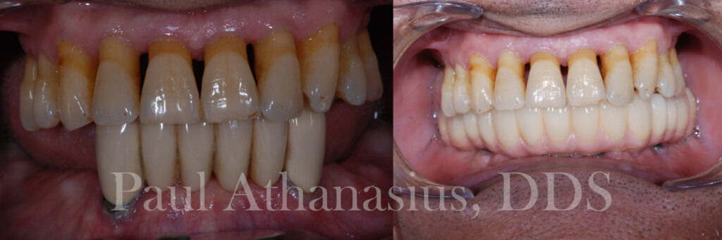 Genuine Family Dentistry | Implant Dentistry, Extractions and Pediatric Dentistry