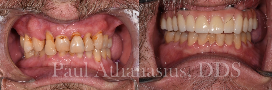 Genuine Family Dentistry | Oral Exams, Veneers and Air Abrasion