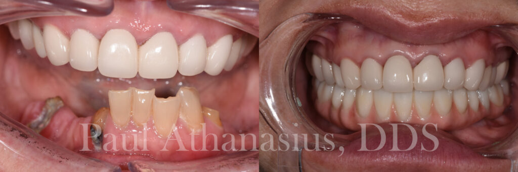 Genuine Family Dentistry | Implant Dentistry, Emergency Treatment and Dental Cleanings