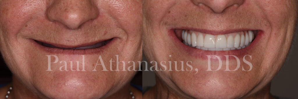 Genuine Family Dentistry | Dentures, Invisalign® and Dental Fillings