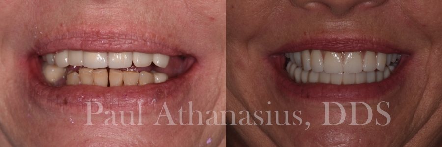 Genuine Family Dentistry | E4D, All-on-4 reg  and Dental Lab