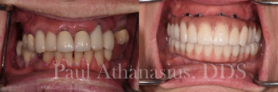 Genuine Family Dentistry | Pediatric Dentistry, Implant Restorations and Oral Exams