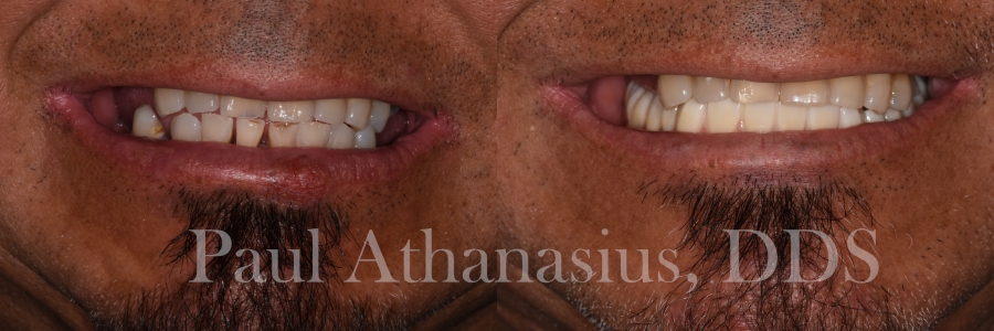 Genuine Family Dentistry | Preventative Program, Dental Cleanings and Dental Lab