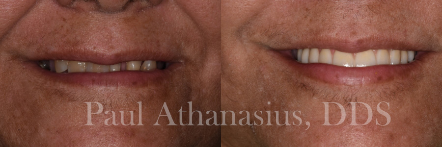 Genuine Family Dentistry | Full Mouth Reconstruction, Emergency Treatment and Ceramic Crowns