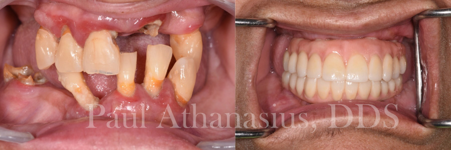 Genuine Family Dentistry | Veneers, Preventative Program and All-on-4 reg 