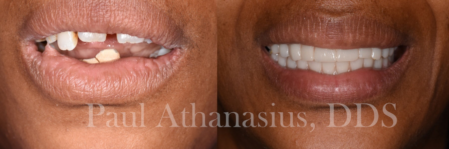 Genuine Family Dentistry | E4D, All-on-6 reg  and LANAP reg 