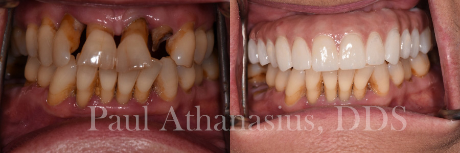 Genuine Family Dentistry | Oral Exams, Veneers and Air Abrasion