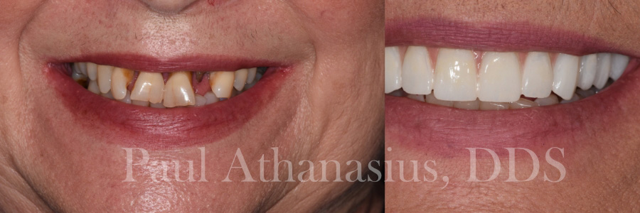 Genuine Family Dentistry | E4D, All-on-4 reg  and Dental Lab